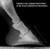 xray_ok.jpg (17511 bytes)